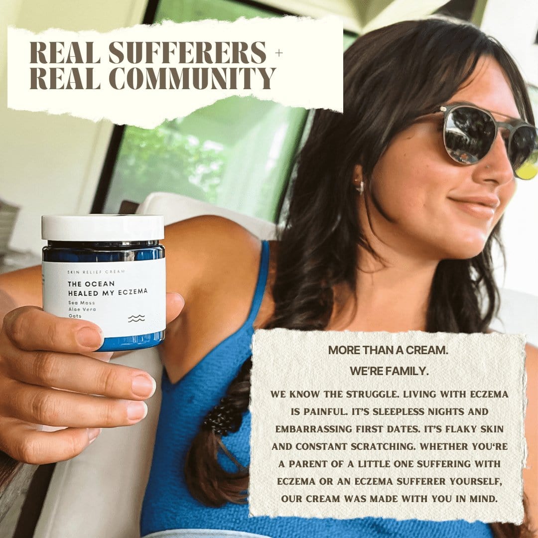 The Ocean Healed My Eczema – Soothing Cream by SeaSkin Naturals™